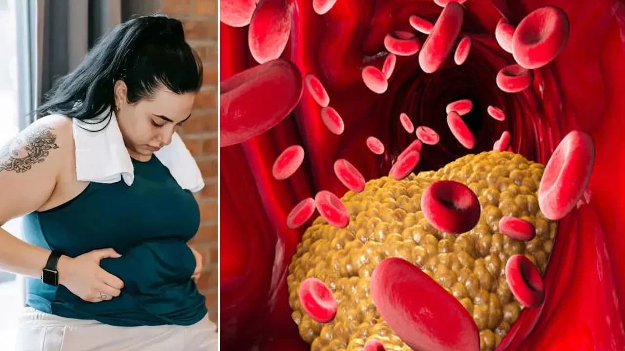 కొలెస్ట్రాల్ పెరిగితే గుండెకు ముప్పు.. డాక్టర్ అజయ్ కుమార్